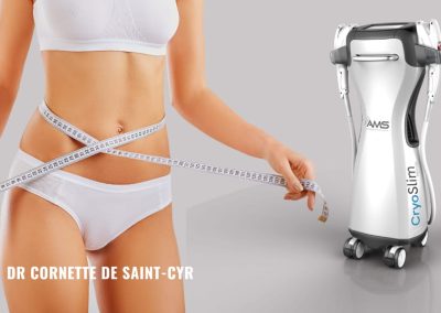 CryoSlim Hybrid à Paris, le meilleur de la cryolipolyse au cabinet Cornette de Saint-Cyr