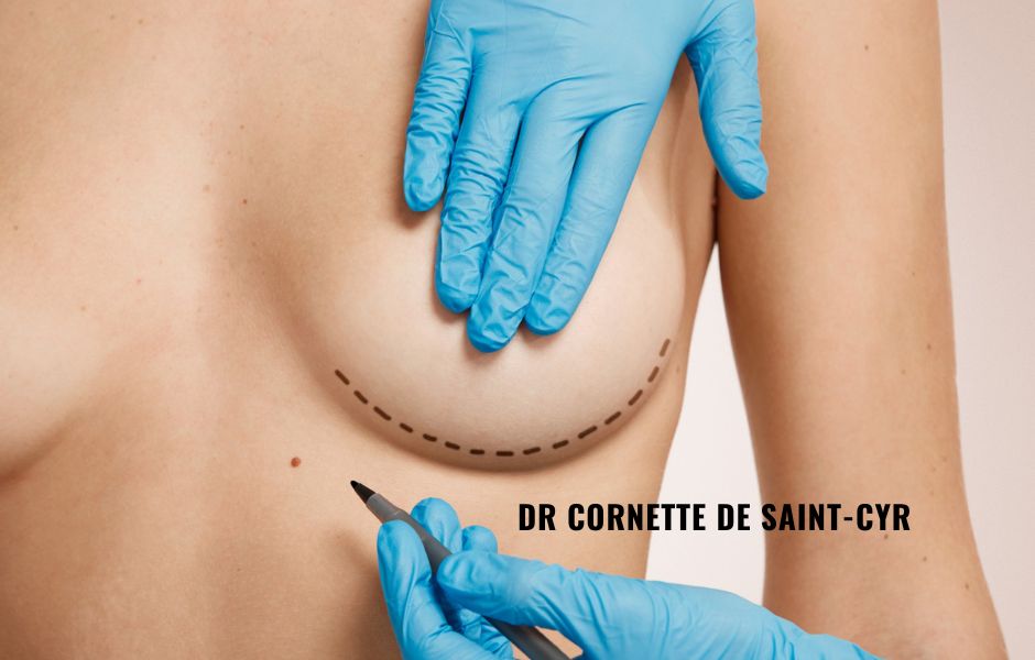 augmentation mammaire prothese