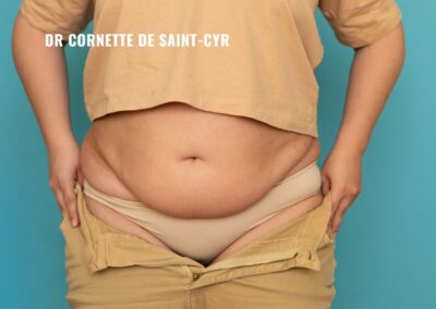 Comment éliminer le tablier abdominal après grossesse ?