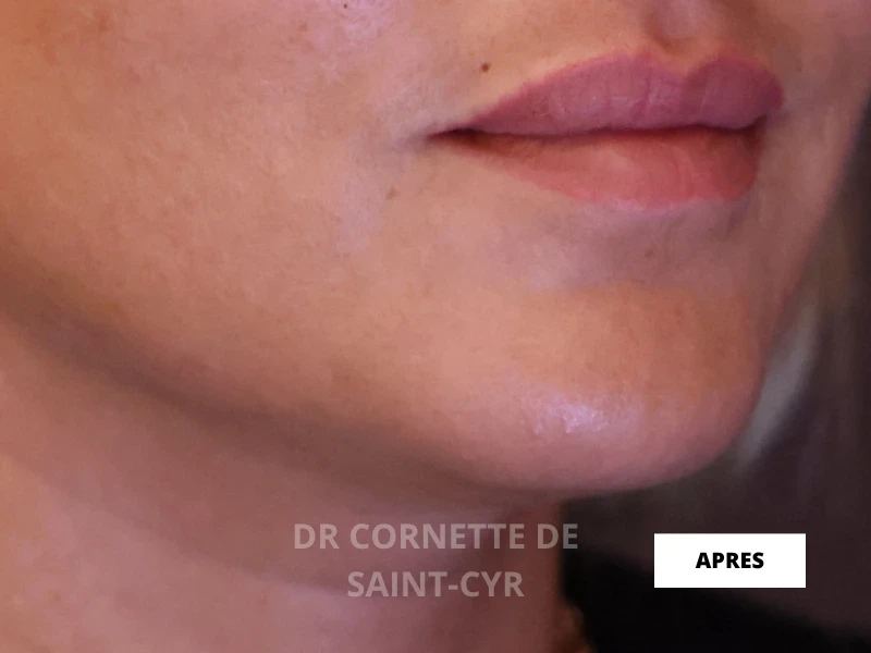 Après Nefertiti