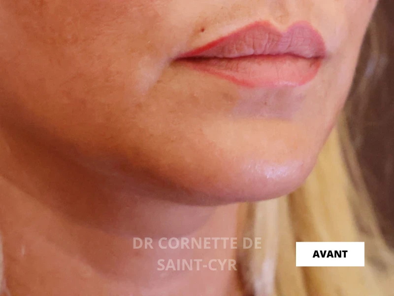 Avant Nefertiti